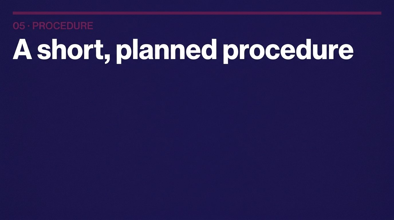 A short, planned procedure — variant B